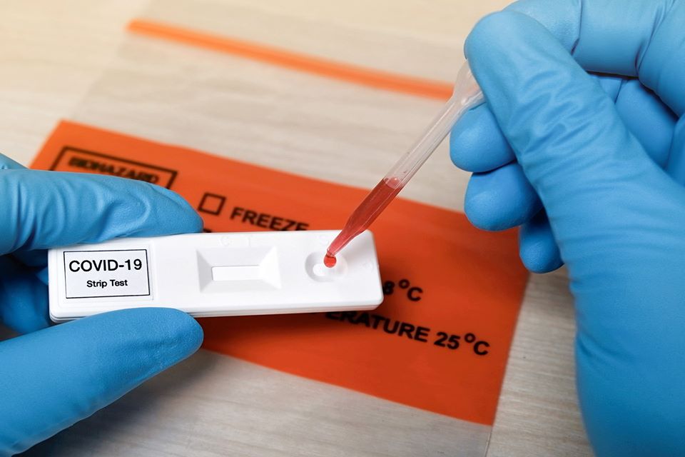 Buy Fake Covid-19 Test Results Buy Fake Covid-19 Test Results