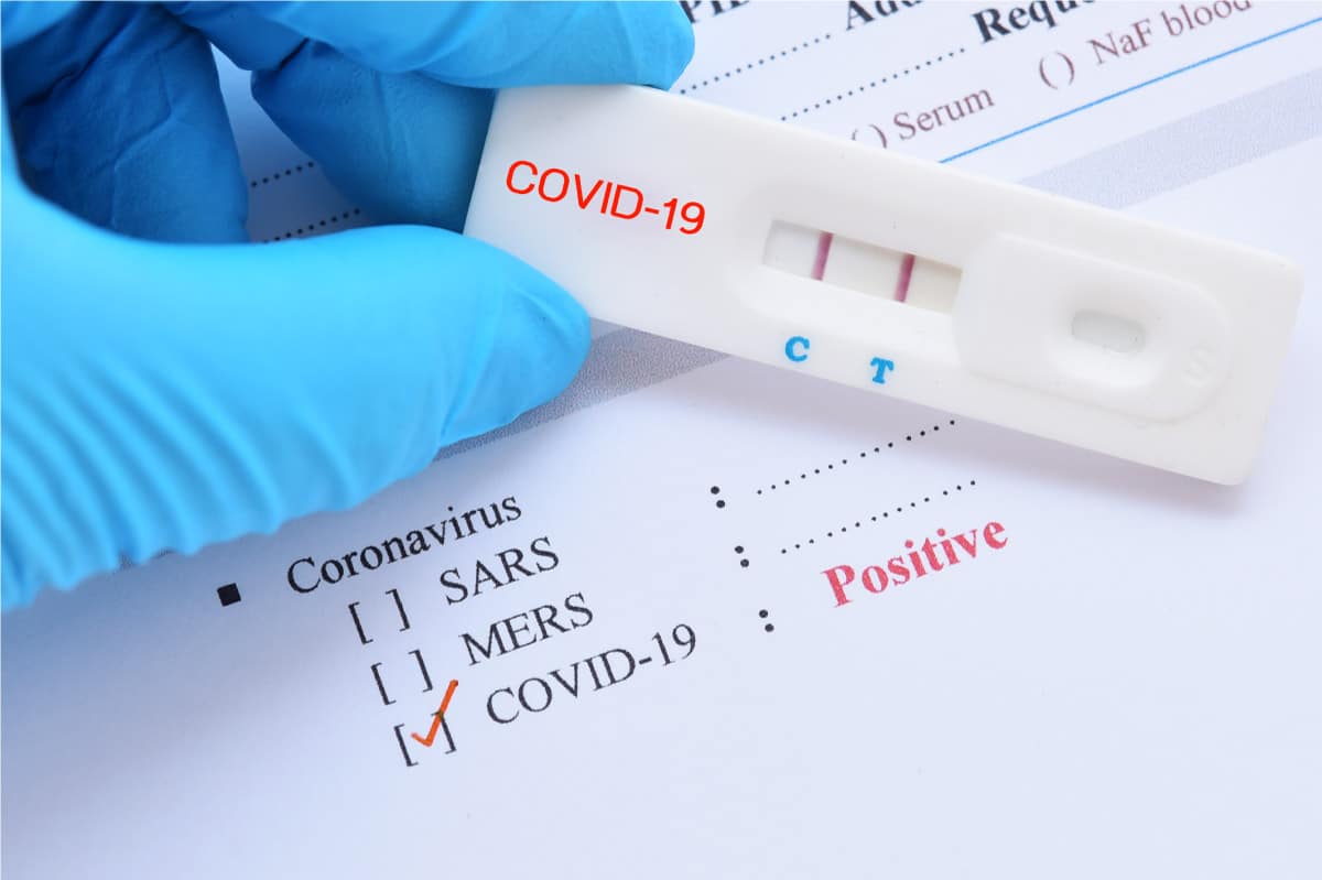 Buy Fake Covid-19 Test Results Buy Fake Covid-19 Test Results